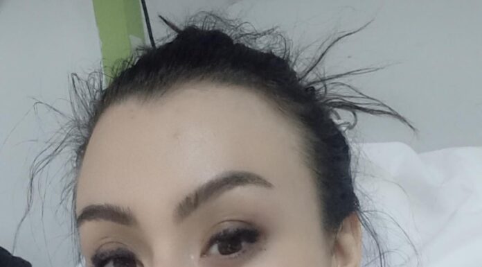 O tânără din Târgu Jiu luptă cu o boală rară și severă: ”Nu mai pot singură…”