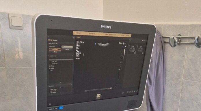 Investiție de peste 430.000 lei pentru sănătatea comunității din Căpreni