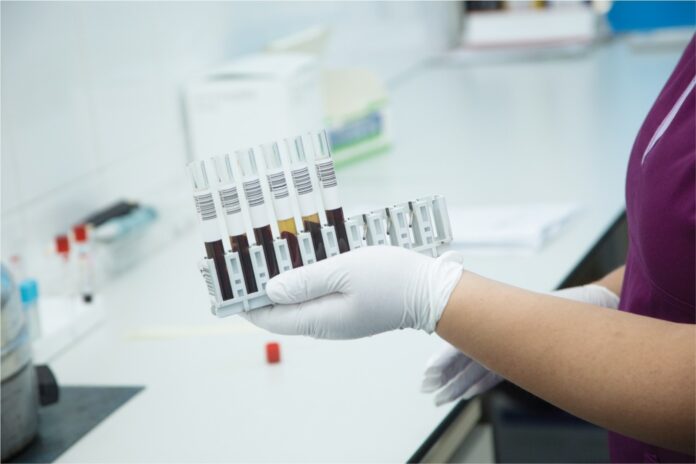 Servicii medicale gratuite pentru gorjeni. Ce analize pot fi făcute fără asigurare