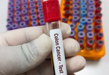 Acces gratuit la testări pentru cancerul colorectal
