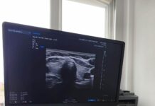 Ecograf ultraperformant pentru o secție a Spitalului Județean