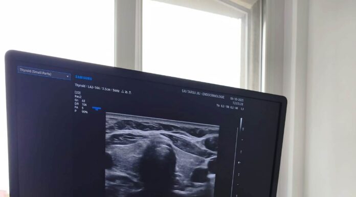 Ecograf ultraperformant pentru o secție a Spitalului Județean