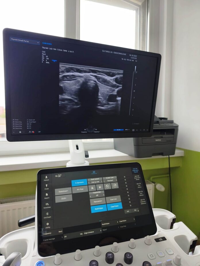 Ecograf ultraperformant pentru o secție a Spitalului Județean
