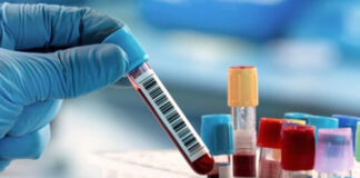 Analize medicale gratuite la Baia de Fier