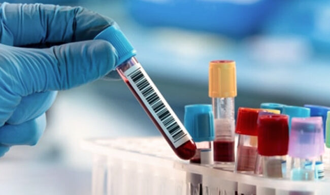 Analize medicale gratuite la Baia de Fier