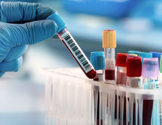 Analize medicale gratuite la Baia de Fier