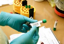 Analize medicale gratuite, prin CAS Gorj, la Spitalul Județean