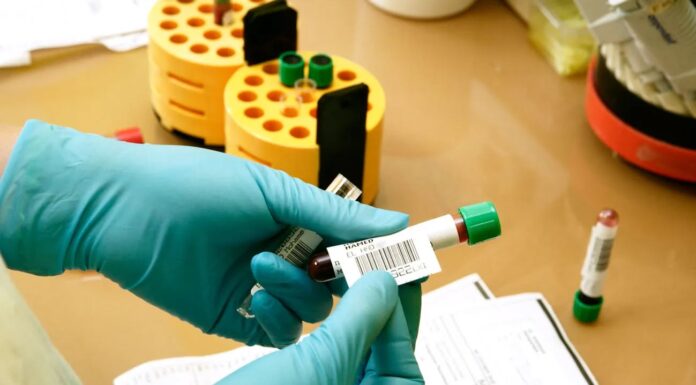 Analize medicale gratuite, prin CAS Gorj, la Spitalul Județean