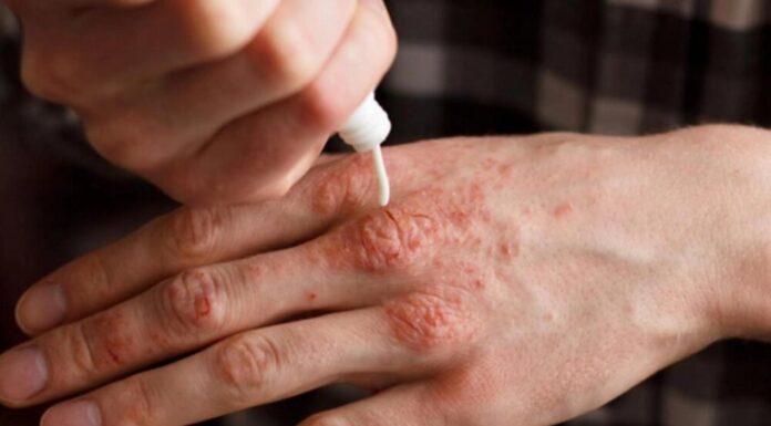 Primul caz de lepră în România, după 44 de ani