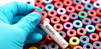 Trei frați, diagnosticați cu malarie după o călătorie în Africa