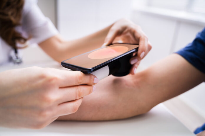 Campanie națională pentru prevenirea cancerului de piele