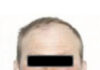 Un pacient care a fugit de la Psihiatrie, găsit după o zi de căutări