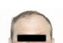 Un pacient care a fugit de la Psihiatrie, găsit după o zi de căutări