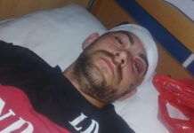 Scandal la Jupânești! Patron de local, acuzat că a bătut cu bestialitate un tânăr, după hora satului!
