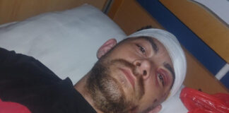 Scandal la Jupânești! Patron de local, acuzat că a bătut cu bestialitate un tânăr, după hora satului!