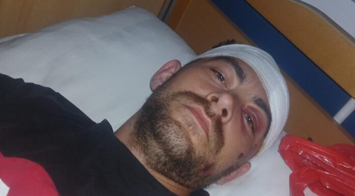 Scandal la Jupânești! Patron de local, acuzat că a bătut cu bestialitate un tânăr, după hora satului!