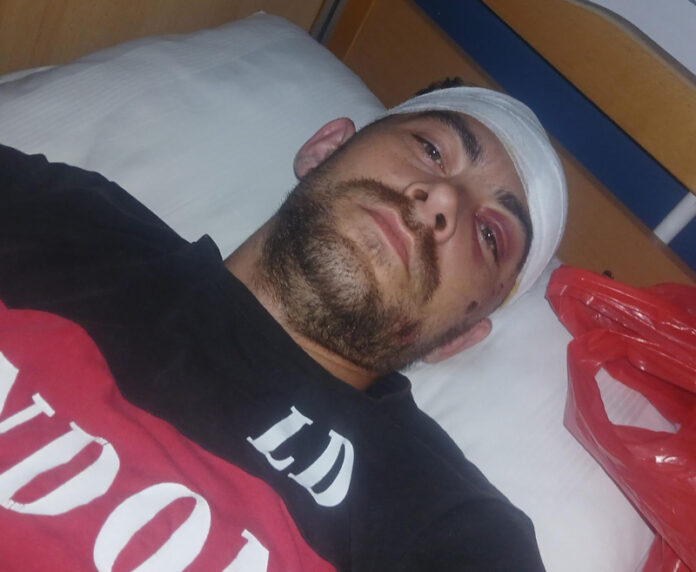Scandal la Jupânești! Patron de local, acuzat că a bătut cu bestialitate un tânăr, după hora satului!