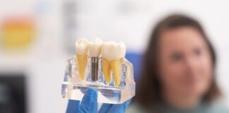 Implantologie ghidata computerizat. Precizia in stomatologia moderna