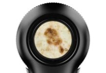 Alunițele pot fi verificate prin dermatoscopie digitală la Spitalul Județean. Investigații gratuite prin CAS