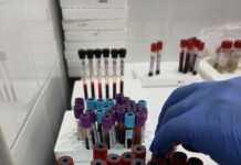 Analize medicale gratuite pentru gorjeni la Spitalul Județean. Cum se fac programările