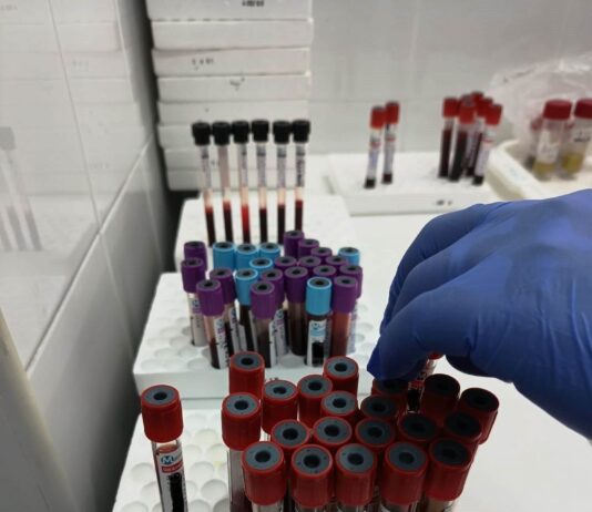 Analize medicale gratuite pentru gorjeni la Spitalul Județean. Cum se fac programările