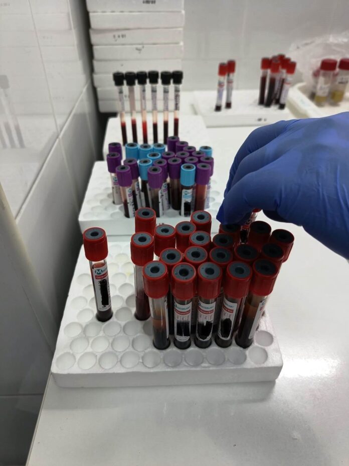 Analize medicale gratuite pentru gorjeni la Spitalul Județean. Cum se fac programările